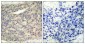 Phospho-LIM Kinase 1 (Thr508) Rabbit pAb ABZ4389