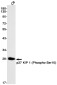 Phospho-p27 KIP 1 (Ser10) Rabbit mAb ABZ4400