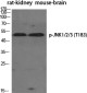 Phospho-JNK1/2/3 (Thr183) Rabbit pAb ABZ4402