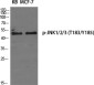 Phospho-JNK1/2/3 (Thr183/Tyr185) Rabbit pAb ABZ4404
