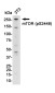 Phospho-mTOR (Ser2448) Rabbit mAb ABZ4407