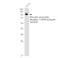 Phospho-Glutamate Receptor 1 (AMPA Subtype) (Ser845) Rabbit mAb ABZ4408