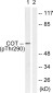 Phospho-MAP3K8/COT (Thr290) Rabbit pAb ABZ4412