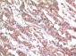 Phospho-STAT3 (Tyr705) (5E9) Mouse mAb ABZ4413