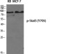 Phospho-STAT3 (Tyr705) Rabbit pAb ABZ4415