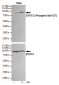 Phospho-STAT3 (Ser727) Rabbit pAb ABZ4417
