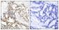 Phospho-BRCA1 (Ser1423) Rabbit pAb ABZ4418