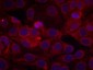 Phospho-VEGF Receptor 2 (Tyr1175) Rabbit pAb ABZ4421