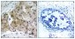 Phospho-VEGF Receptor 2 (Tyr1175) Rabbit pAb ABZ4421