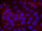 Phospho-VEGF Receptor 2 (Tyr1214) Rabbit pAb ABZ4422