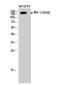 Phospho-IRS1 (Ser636) Rabbit pAb ABZ4423