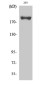 Phospho-IRS1 (Ser639) Rabbit pAb ABZ4424