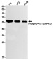 Phospho-AKT1 (Ser473) Rabbit mAb ABZ4428