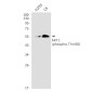 Phospho-AKT1 (Thr450) Rabbit mAb ABZ4429
