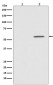 Phospho-AKT1 (Ser124) Rabbit mAb ABZ4431
