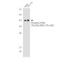 Phospho-ERK1/2 (Thr202/Thr185) Rabbit mAb ABZ4433