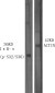 Phospho-IKB alpha (Ser32/Ser36) Rabbit pAb ABZ4439