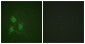 Phospho-PKA alpha/beta/gamma (Thr197) Rabbit pAb ABZ4440