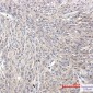 Phospho-PKC (Ser660) Rabbit mAb ABZ4442