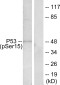 Phospho-p53 (Ser15) Rabbit pAb ABZ4443