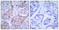 Phospho-HER2 (Tyr1221/Tyr1222) Rabbit pAb ABZ4445