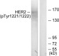 Phospho-HER2 (Tyr1221/Tyr1222) Rabbit pAb ABZ4445