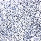 Phospho-Glucocorticoid Receptor (Ser226) Rabbit mAb ABZ4447