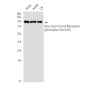 Phospho-Glucocorticoid Receptor (Ser226) Rabbit mAb ABZ4447
