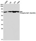 Phospho-Raf1 (Ser259) Rabbit mAb ABZ4448