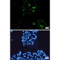 Phospho-c-Myc (Ser62) Rabbit mAb ABZ4449