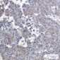 Phospho-EGFR (Tyr1092) Rabbit mAb ABZ4451