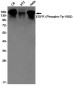 Phospho-EGFR (Tyr1092) Rabbit mAb ABZ4451