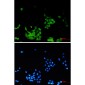 Phospho-EGFR (Tyr1173) Rabbit mAb ABZ4452