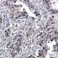 Phospho-EGFR (Tyr1173) Rabbit mAb ABZ4452