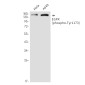 Phospho-EGFR (Tyr1173) Rabbit mAb ABZ4452