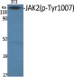 Phospho-JAK2 (Tyr1007) Rabbit pAb ABZ4460