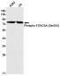 Phospho-FOXO3A (Ser253) Rabbit mAb ABZ4461