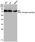 Phospho-TAK1 (Ser439) Rabbit mAb ABZ4463