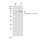 Phospho-IKK alpha (Thr23) Rabbit pAb ABZ4464