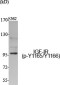 Phospho-IGF1 Receptor (Tyr1165/Tyr1166) Rabbit pAb ABZ4469