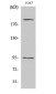 Phospho-IGF1 Receptor (Tyr1165/Tyr1166) Rabbit pAb ABZ4469