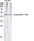 Phospho-MEK2 (Thr394) Rabbit pAb ABZ4470