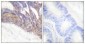 Phospho-LAT (Tyr191) Rabbit pAb ABZ4473