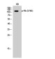 Phospho-Rb (Ser780) Rabbit pAb ABZ4475