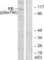 Phospho-Rb (Ser780) Rabbit pAb ABZ4475