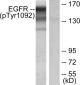 Phospho-EGFR (Tyr1092) Rabbit pAb ABZ4476