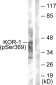 Phospho-kappa Opioid Receptor (Ser369) Rabbit pAb ABZ4478