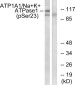 Phospho-Sodium Potassium ATPase (Ser23) Rabbit pAb ABZ4479