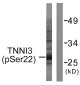 Phospho-Cardiac Troponin I (Ser22/Ser23) Rabbit pAb ABZ4480