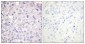 Phospho-IKK beta (Tyr188) Rabbit pAb ABZ4481